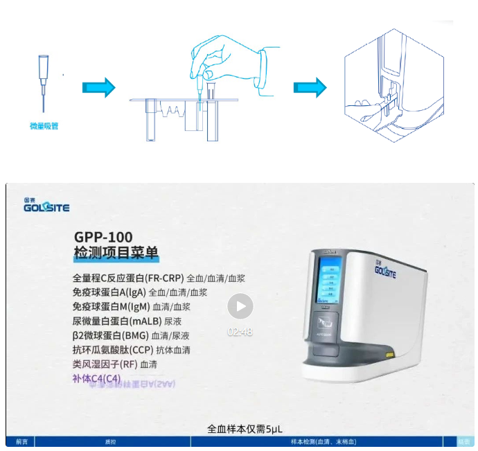 小仪器大创新：GPP-100单人份特定蛋白分析仪